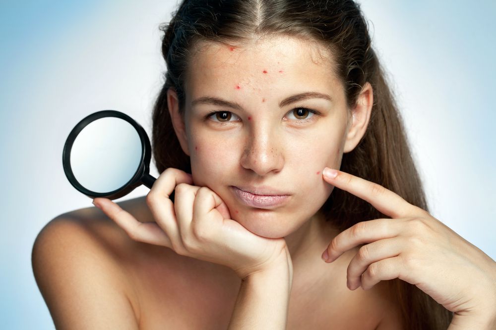 Problemas de pele: saiba quais são os principais e como evitar