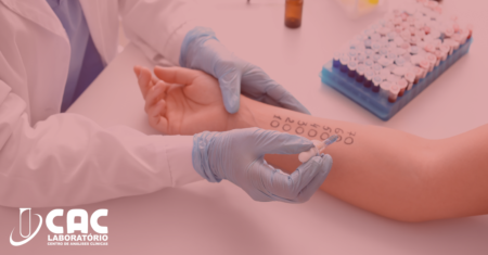 Como os Exames Laboratoriais Auxiliam no Diagnóstico de Alergias
